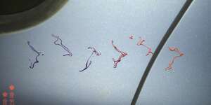 Sucker (Liz Lawrence RMX)