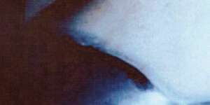 Syndrome Of The Century