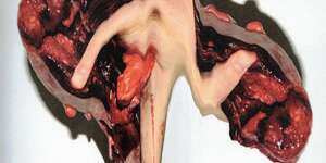 Peonia (Dormente Remix)