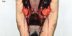 Fog (Petrolio Remix)